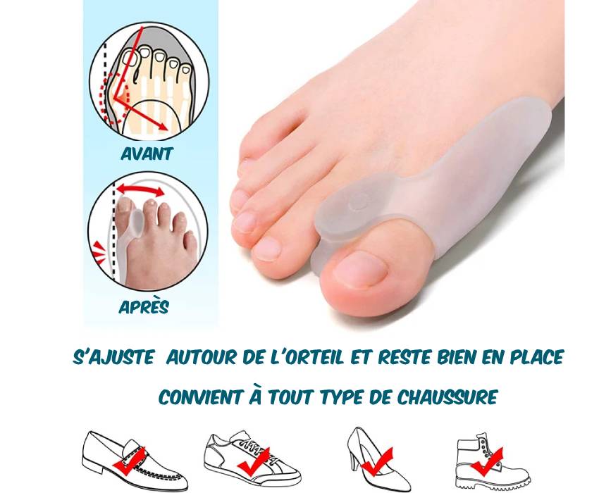 Correcteur Hallux Valgus en silicone HalluxFlex