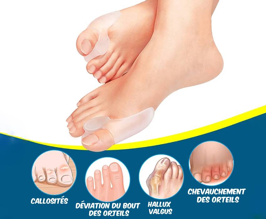 Correcteur Hallux Valgus en silicone HalluxFlex